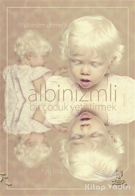 Albinizmli Bir Çocuk Yetiştirmek - 1