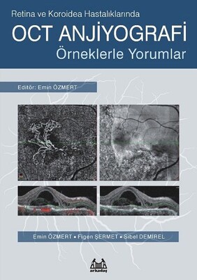 Retina ve Koroidea Hastalıklarında OCT Anjiyografi - Arkadaş Yayınları