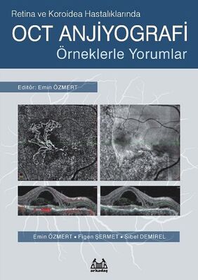 Retina ve Koroidea Hastalıklarında OCT Anjiyografi - 1